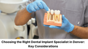 Choosing the Right Dental Implant Specialist in Denver