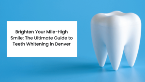 Guide to Teeth Whitening in Denver